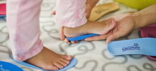 Valgus leg deformation in children