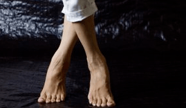 Deformity