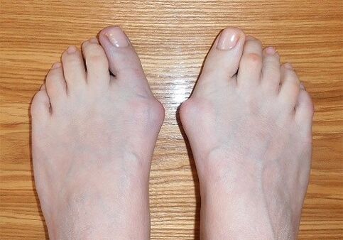 Foot -to -leg